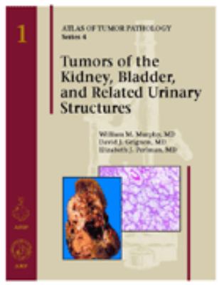 Tumors of the kidney, bladder, and related urinary structures