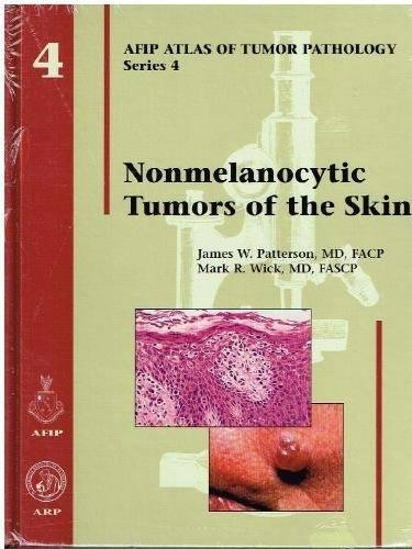 Nonmelanocytic tumors of the skin