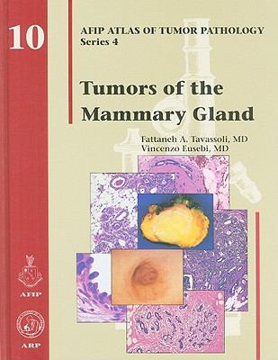 Tumors of the mammary gland