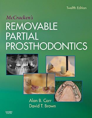 McCracken's removable partial prosthodontics.