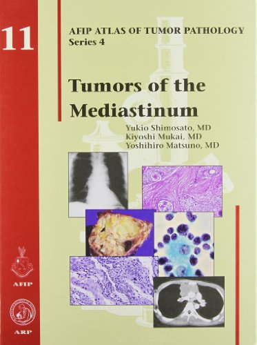Tumors of the mediastinum