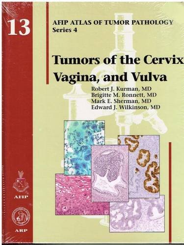 Tumors of the cervix, vagina, and vulva