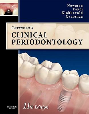 Carranza's clinical periodontology