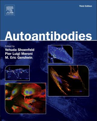 Autoantibodies.