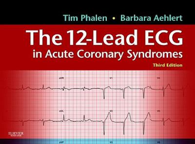 The 12-lead ECG in acute coronary syndromes