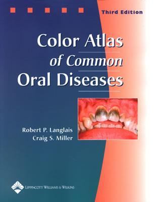 Color atlas of common oral diseases