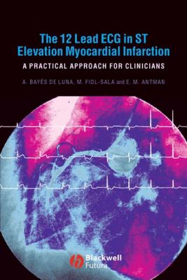 The 12-lead ECG in ST elevation myocardial infarction : a practical approach for clinicians