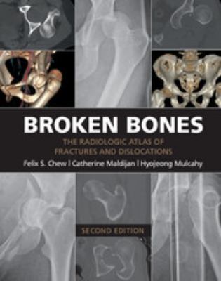 Broken bones : the radiologic atlas of fractures and dislocations