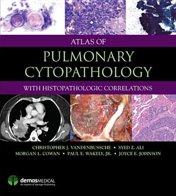 Atlas of pulmonary cytopathology : with histopathologic correlations