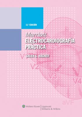 Marriott Electrocardiografía Práctica.