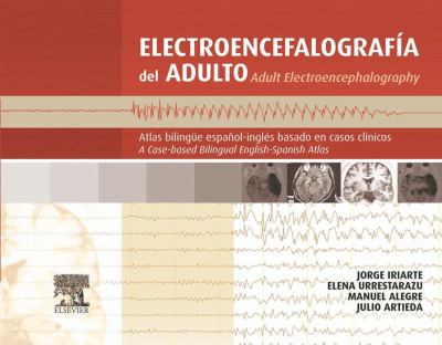 Electroencefalografía del adulto : atlas bilingüe español-inglés basado en casos clínicos = Adult electroencephalography : a case-based bilingual English-Spanish atlas