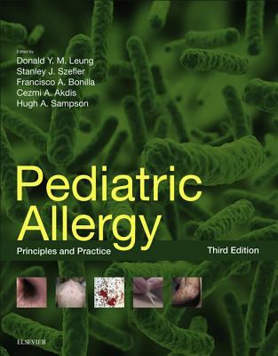 Pediatric allergy : principles and practice