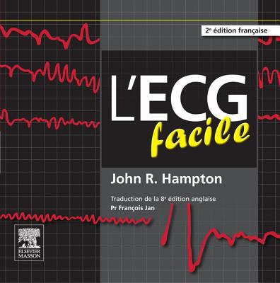 L'ECG facile