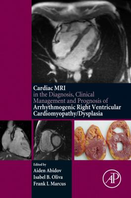 The cardiac MRI in diagnosis, clinical management, and prognosis of arrhythmogenic right ventricular cardiomyopathy dysplasia