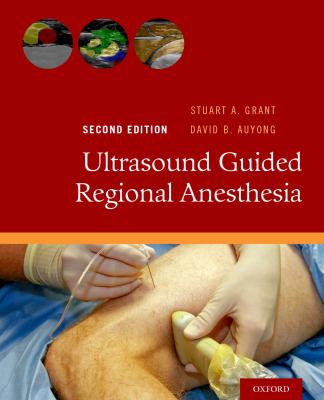 Ultrasound guided regional anesthesia