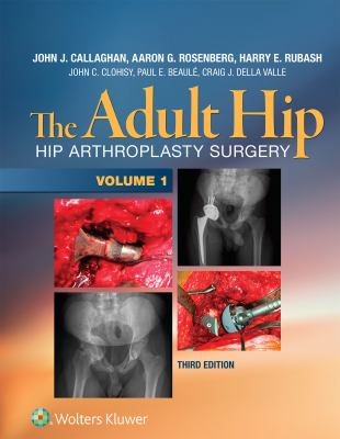 The adult hip : hip arthroplasty surgery