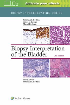 Biopsy interpretation of the bladder