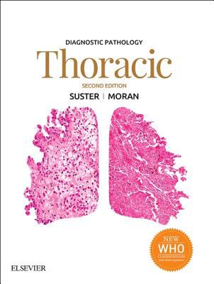 Thoracic