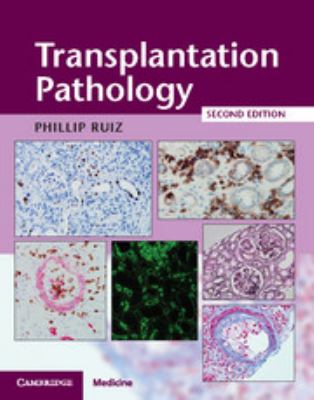 Transplantation pathology