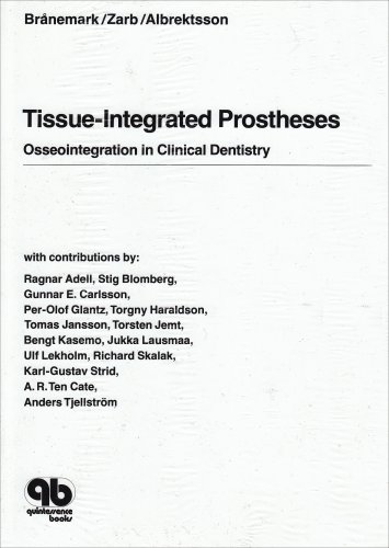 Tissue-integrated prostheses : osseointegration in clinical dentistry