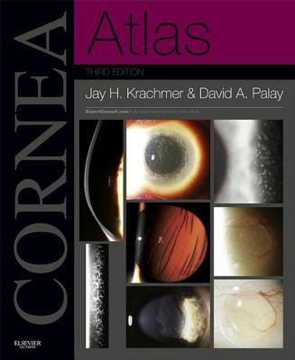 Cornea atlas