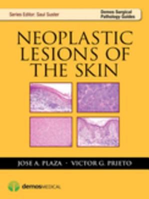 Neoplastic Lesions of the Skin.