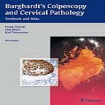 Burghardt's colposcopy and cervical pathology : textbook and atlas