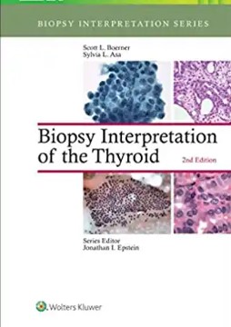 Biopsy interpretation of the thyroid