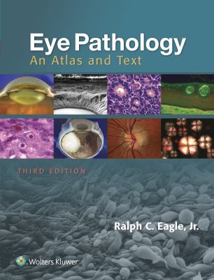 Eye pathology : an atlas and text