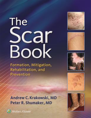 The scar book : formation, mitigation, rehabilitation, and prevention