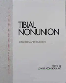 Tibial nonunion : diagnosis and treatment