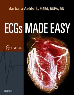 ECGs made easy