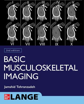 Basic musculoskeletal imaging