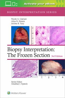 Biopsy interpretation : the frozen section