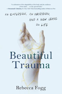 Beautiful trauma : an explosion, an obsession, and a new lease on life