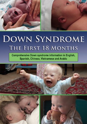 Down syndrome : the first 18 months